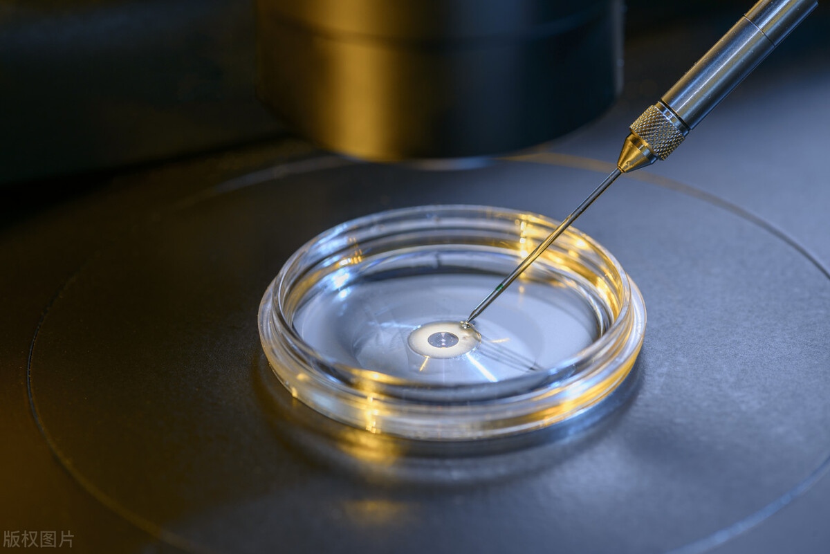 男性如果有无精症就会绝后吗,男人被诊断出不育是什么原因