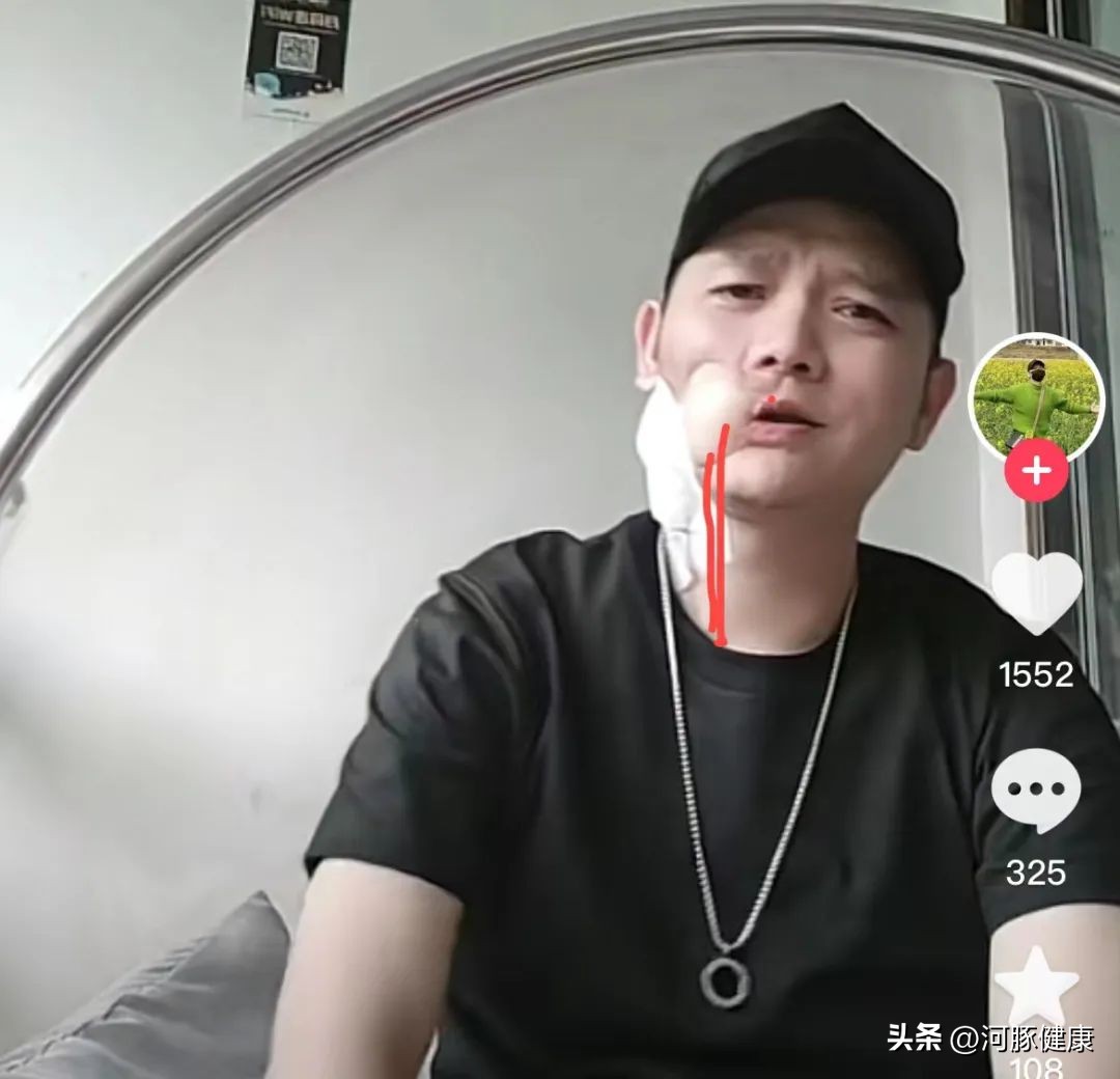 傅松槟榔,36岁歌手傅松因口腔癌去世