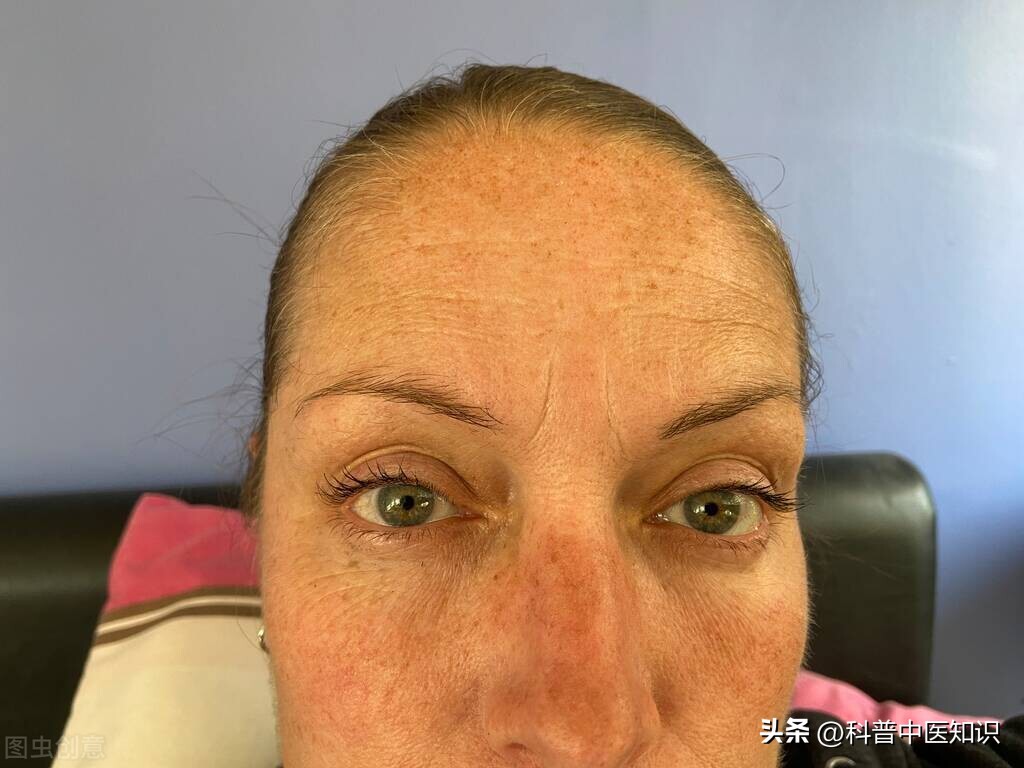 脸上有斑暗黄中医怎么调理,中药调理褐斑一般多久能见效