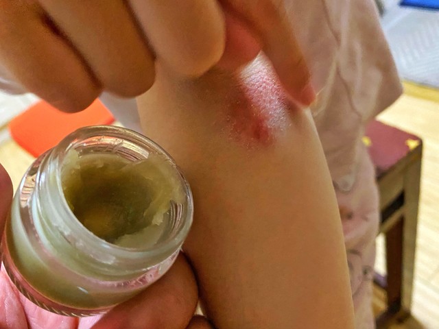 哪些药对人有一定的危险,哪些是小孩禁用的药