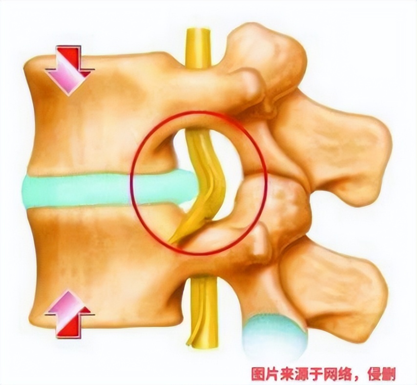 为什么医生建议腰痛的人睡硬板床,硬板床缓解腰痛医生教你选床垫