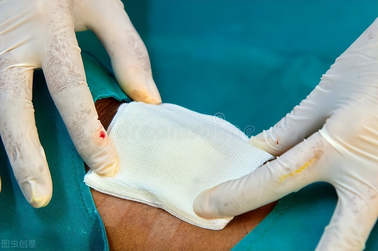 术后伤口愈合慢有必要再缝合吗,开放性伤口快速愈合的方法