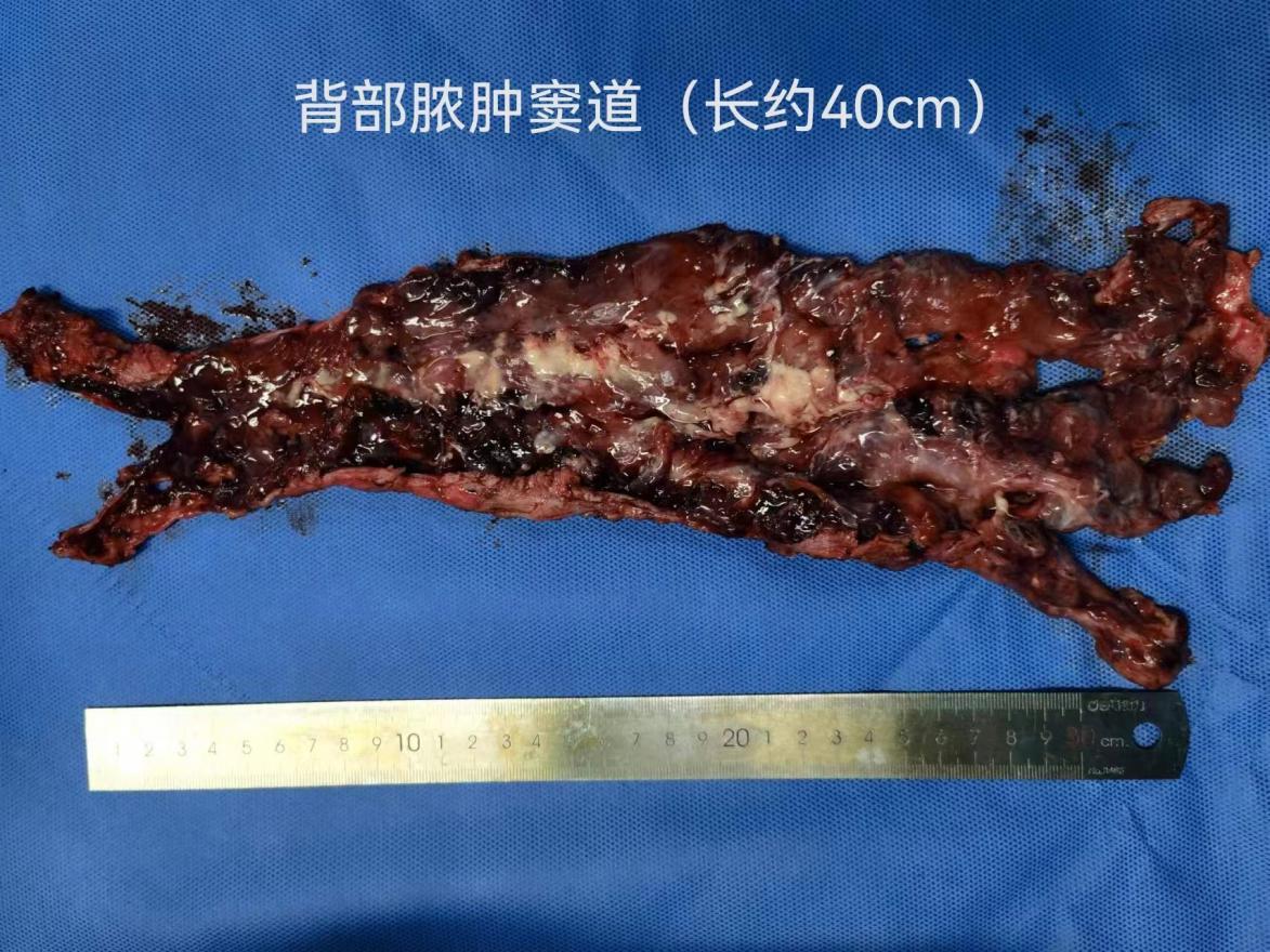 体表包块,体表包块常见吗