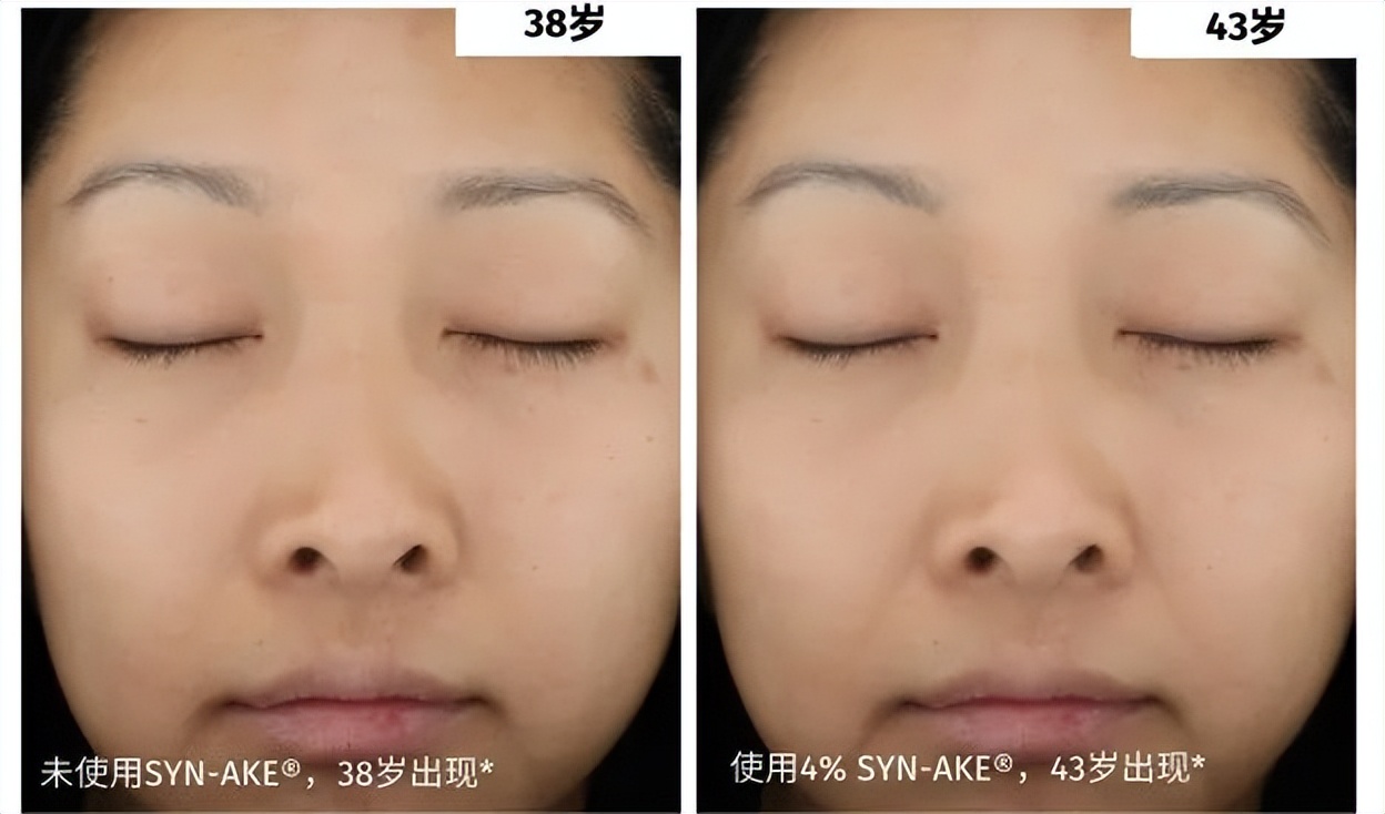 知道它的人不多，但四五十岁女性用了真的能淡纹，值得一看