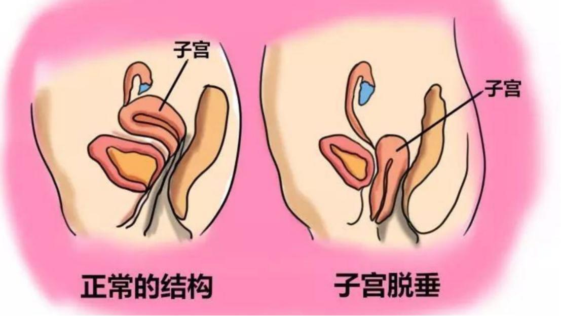 注意功能障碍属于什么障碍,注意性缺陷多动障碍临床表现
