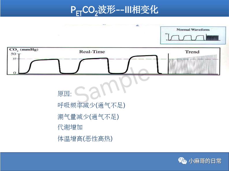 呼气末二氧化碳检测图的解读,呼气末二氧化碳检测操作视频
