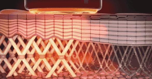 美容院皮肤管理rf射频仪,射频技术在美容整形中的应用进展