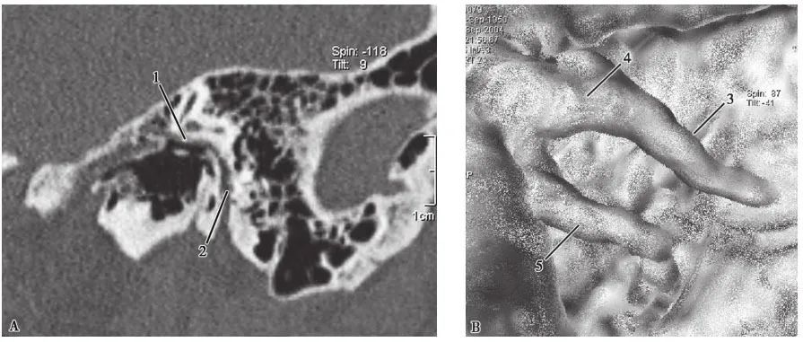 耳部解剖结构和生理功能,耳部解剖笔记