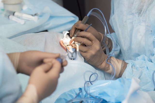 癫痫手术治疗费用大概需要多少钱,肌阵挛癫痫可以手术治疗吗