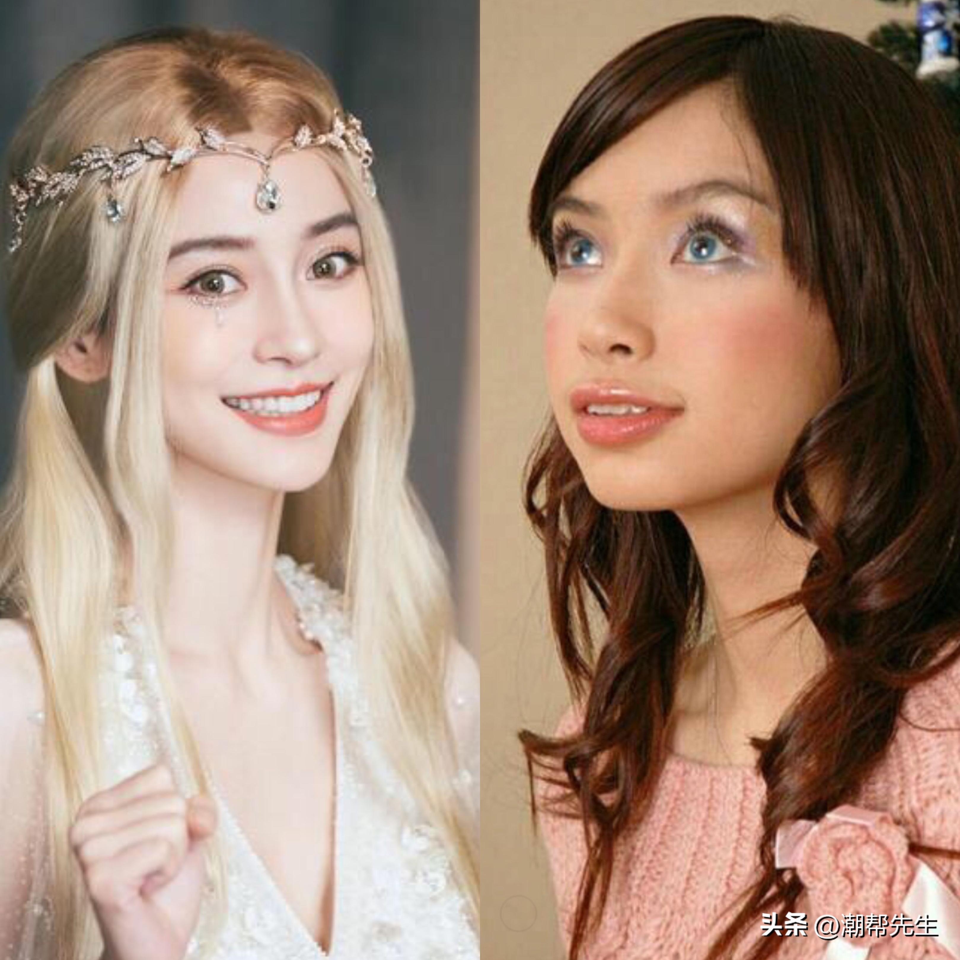 如何辨别唇性嘴凸和齿性嘴凸,嘴凸和嘴龅的区别