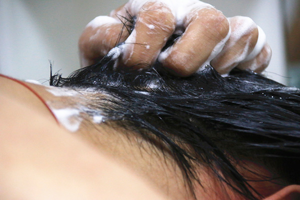 头皮屑大块严重是什么原因,头皮屑大块大块的怎么回事