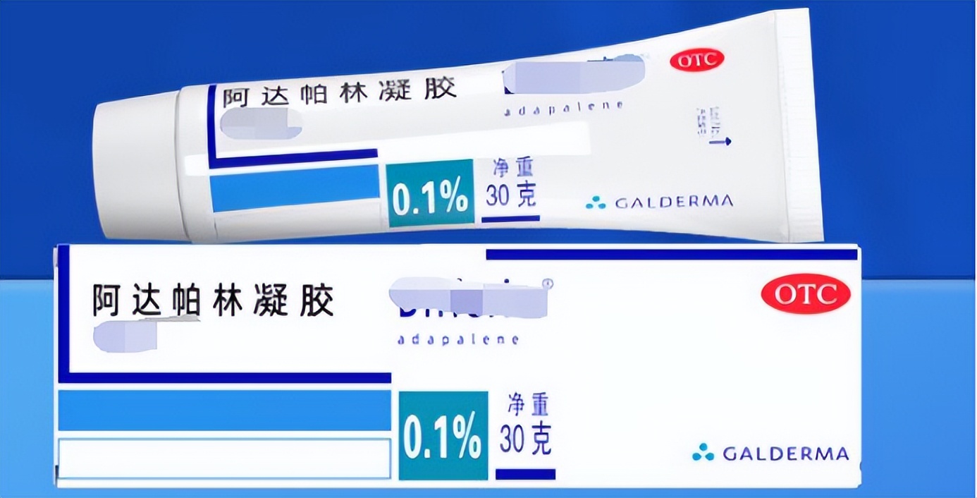 不同原因形成的青春痘，其治疗方式都一样吗？医生：女生不一样