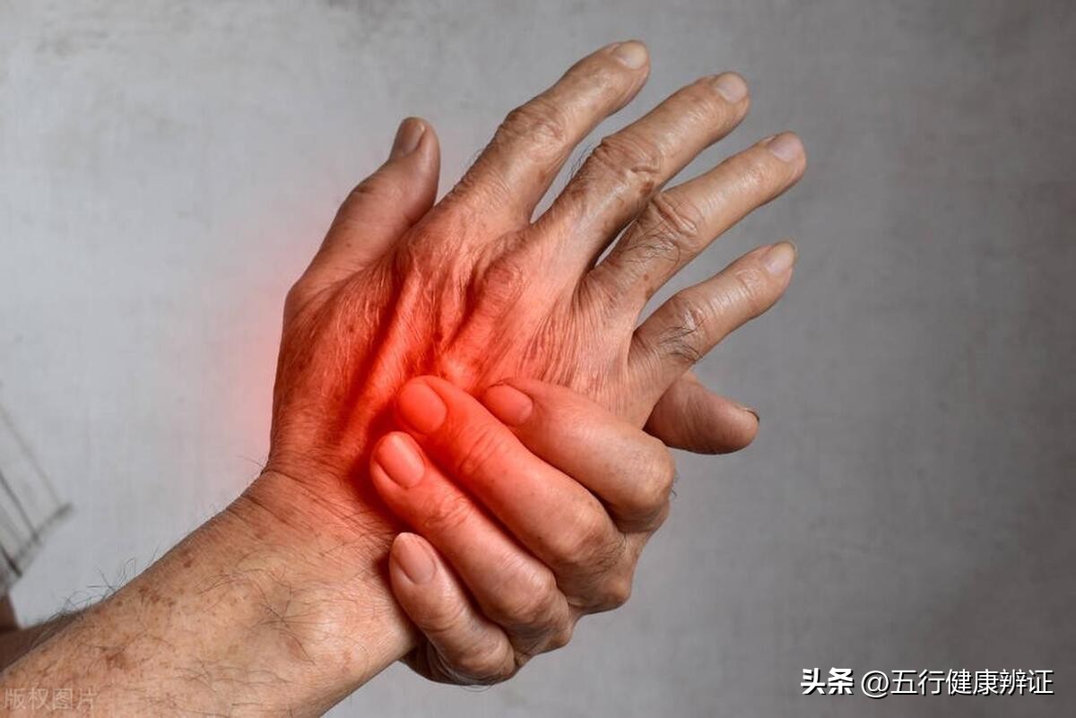 风湿关节炎反复发作怎么办？简单一味药，或可改善风湿性关节炎