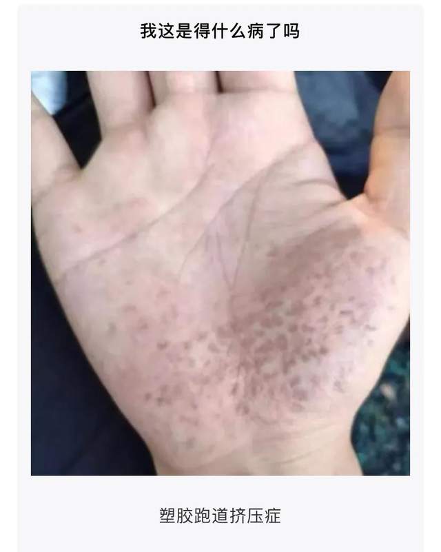 脚气脚臭挂什么科,脚臭看医生挂什么科