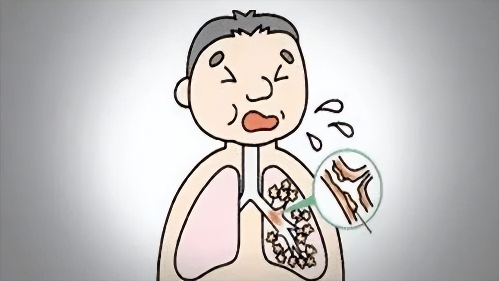 嗓子有痰咳不出来有什么小妙招,嗓子里有痰咳不出这个方法最管用