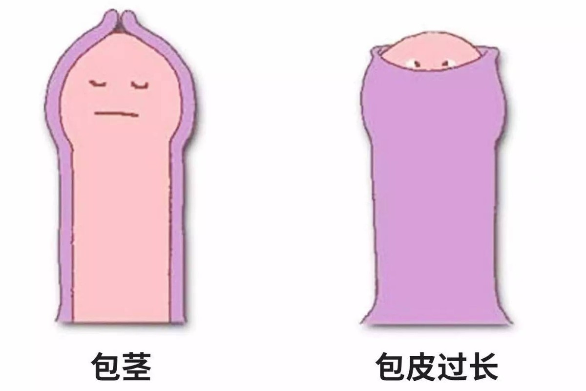 没割包皮的男生多吗,没割包皮的男生