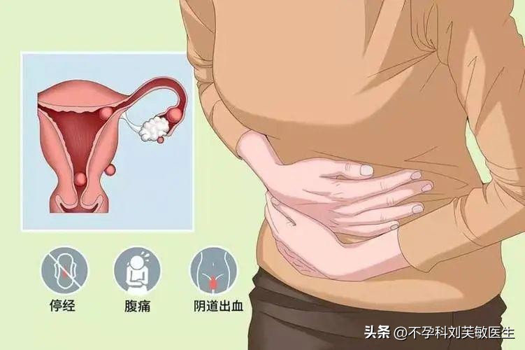 阴道不规律的出血有些什么症状,阴道不正常出血有什么症状