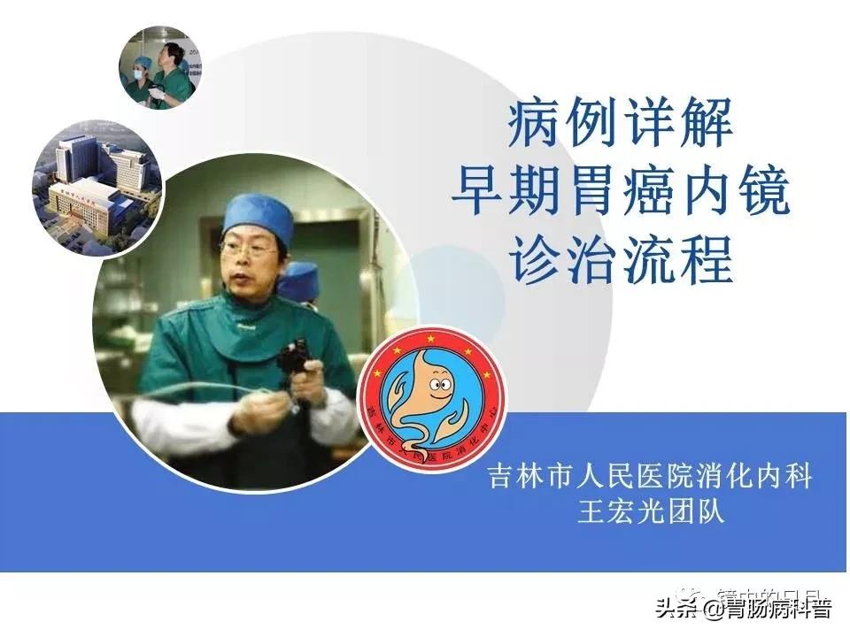 胃癌可以做内镜手术吗,早期胃癌内镜手术后追加外科手术