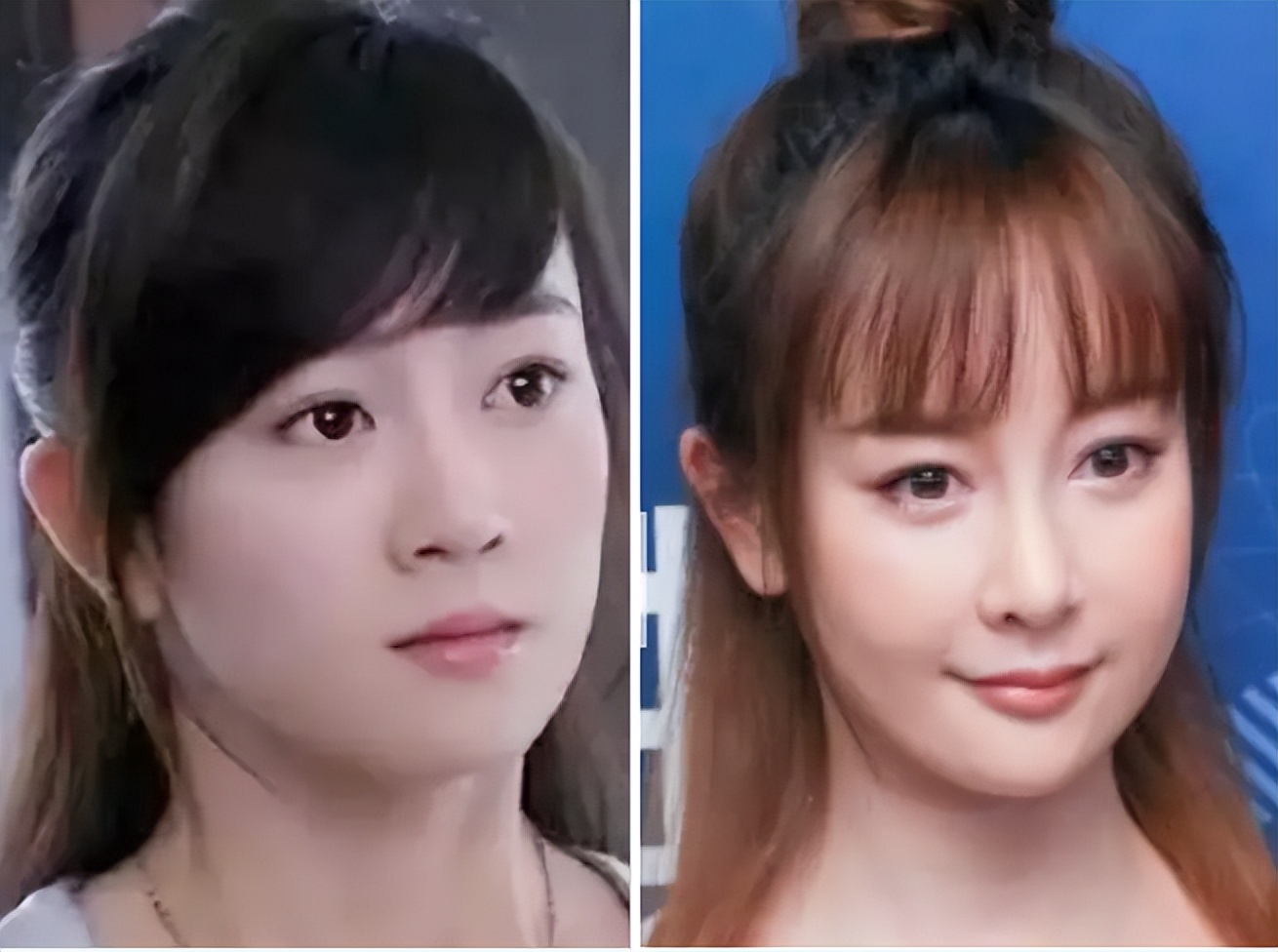 扁平脸影响美感,扁平头会对颜值有影响吗