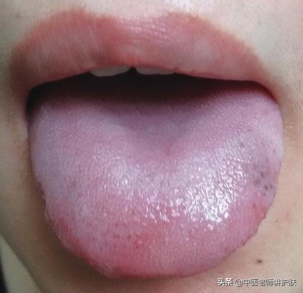 色斑也得分类别,从中医角度浅谈色斑成因,这样治疗更有效