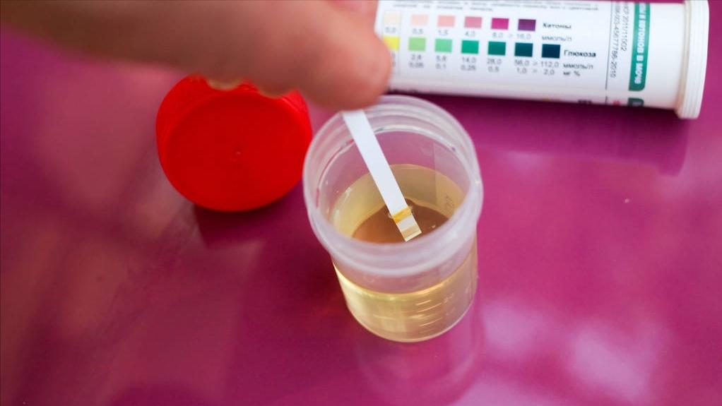 治疗肾病的西药有哪些效果好,肾病前沿治疗又有了新突破