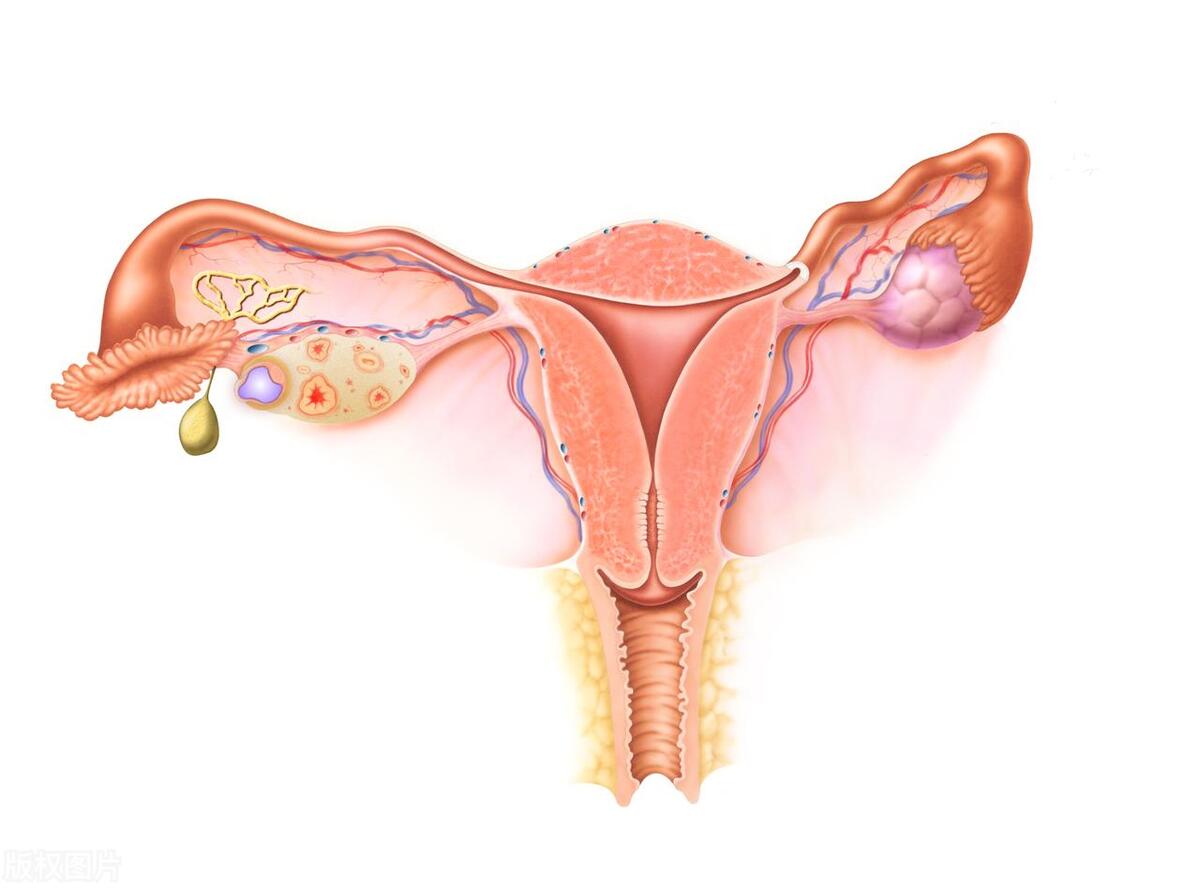我60岁热爱跳舞，跟舞伴跳得正开心时，突然私密处掉了个东西