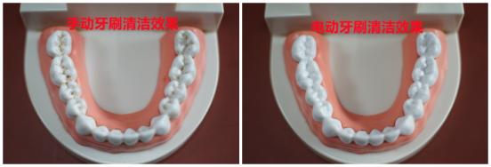 电动牙刷真的可以将牙齿刷白吗,电动牙刷和普通牙刷哪个对牙齿好