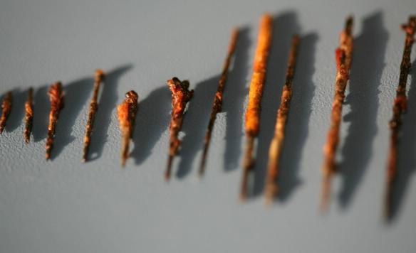 云南女子体内26根绣花针凶手是谁,云南女子缝衣针