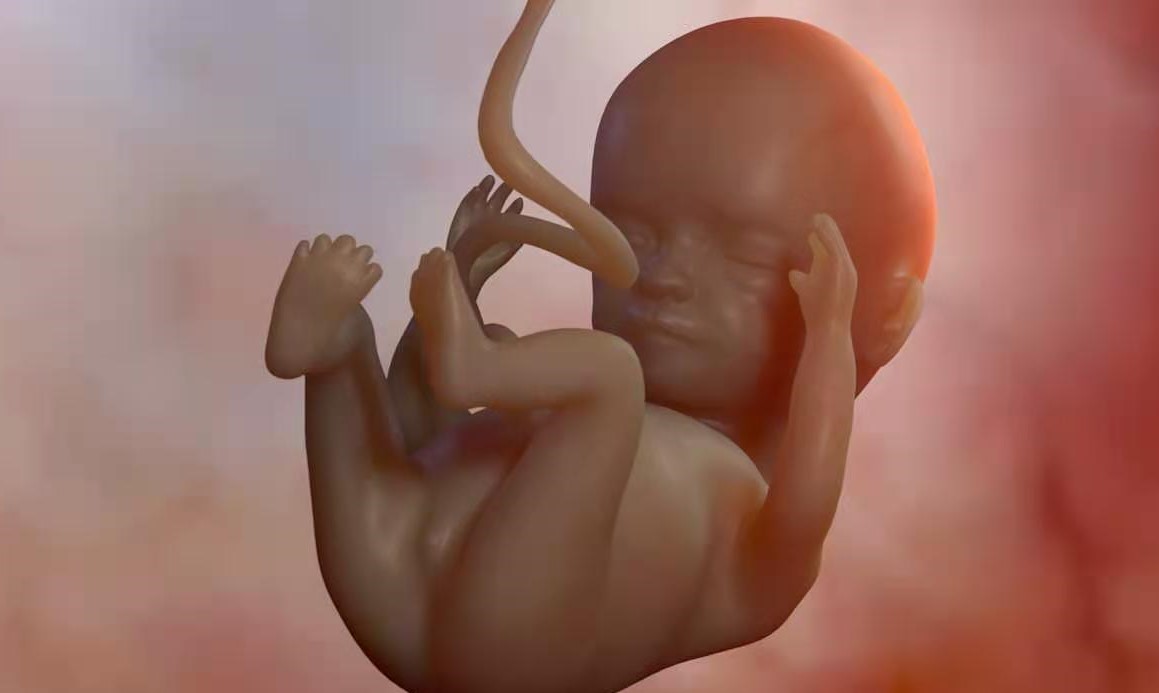 婴儿轻度脑积水是什么原因引起,新生儿轻微脑积水怎么治