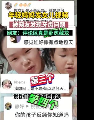 妈妈发视频被网友提醒反颌,家长担心孩子反颌如何回复