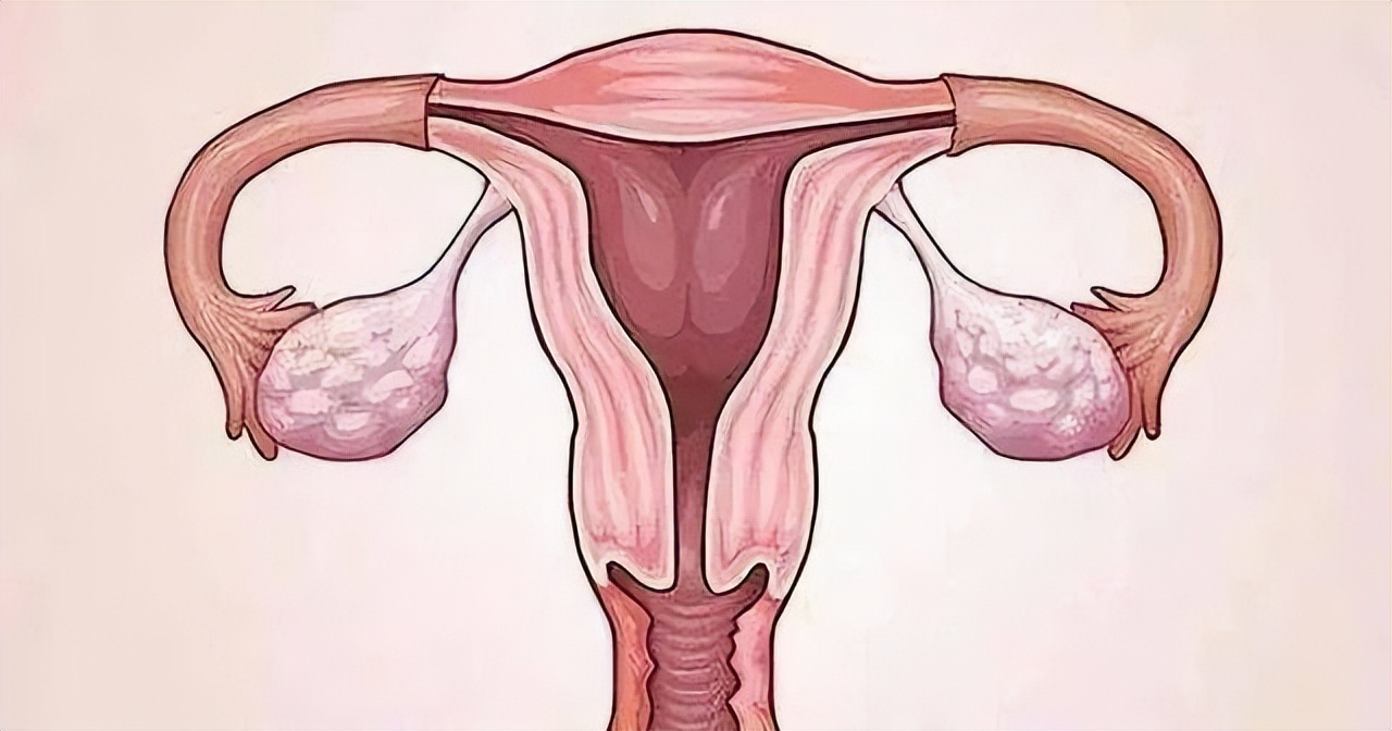 没了子宫的女人案例,没有子宫的女人和正常女人的区别