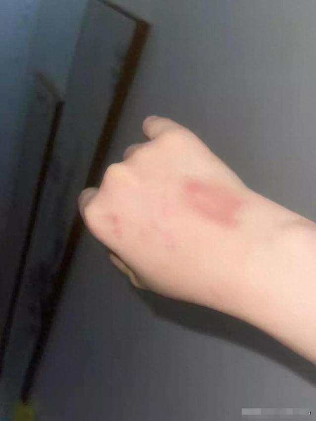 闹大了！电梯内狗尾巴扫腿，23岁女子在打斗中被扯下衣服！真惨烈