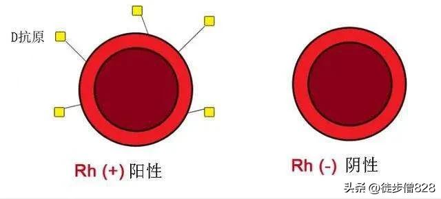 rh血型可以给abo型血输血吗,rh阴性血输血还要看abo血型吗