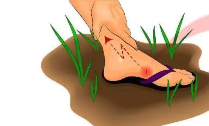 被铁钉扎了一下一定要打破伤风吗,铁钉扎破一点需要打破伤风