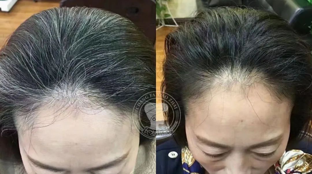 淘米水让白发变黑发吗,淘米水洗发水真的能让白发变黑吗