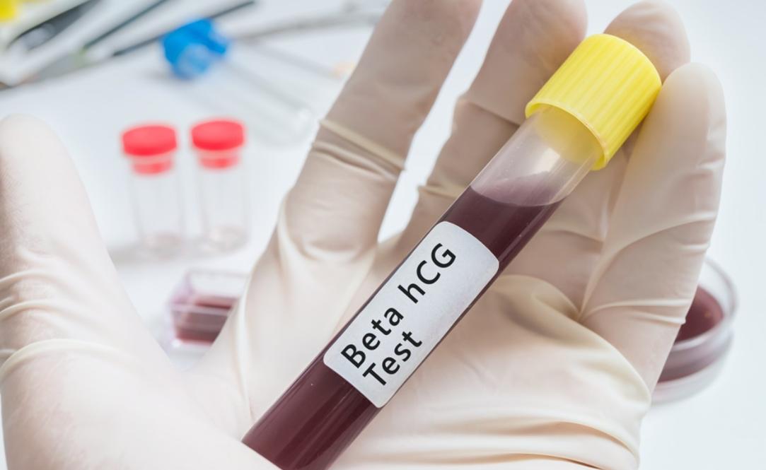 医生坦言：女人生没生过娃，一眼就能看出来，这3点不同很明显！