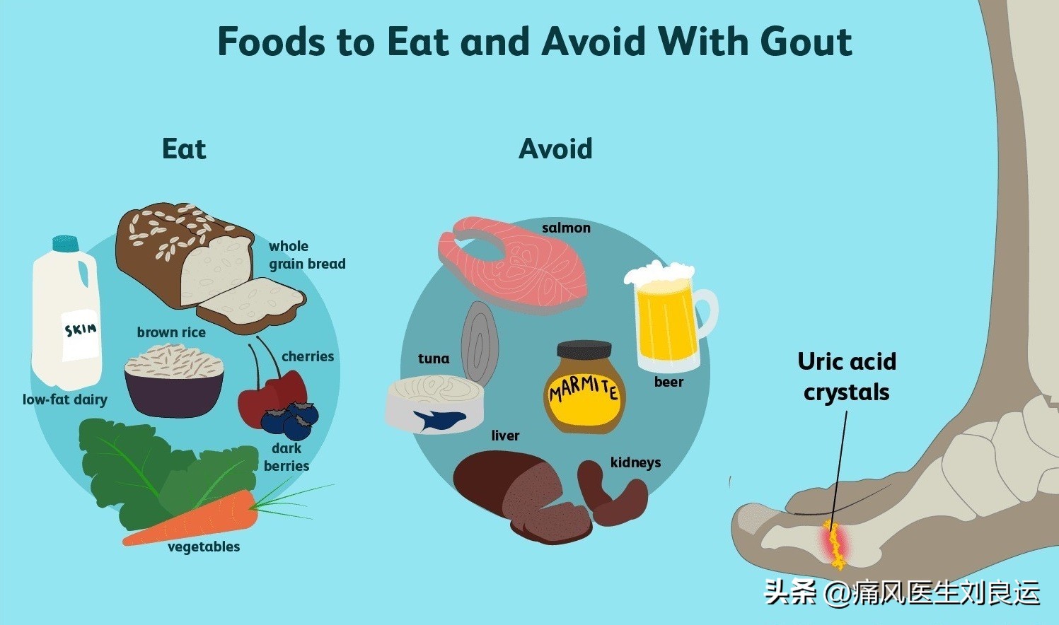尿酸高为什么,血尿酸高为什么会痛风