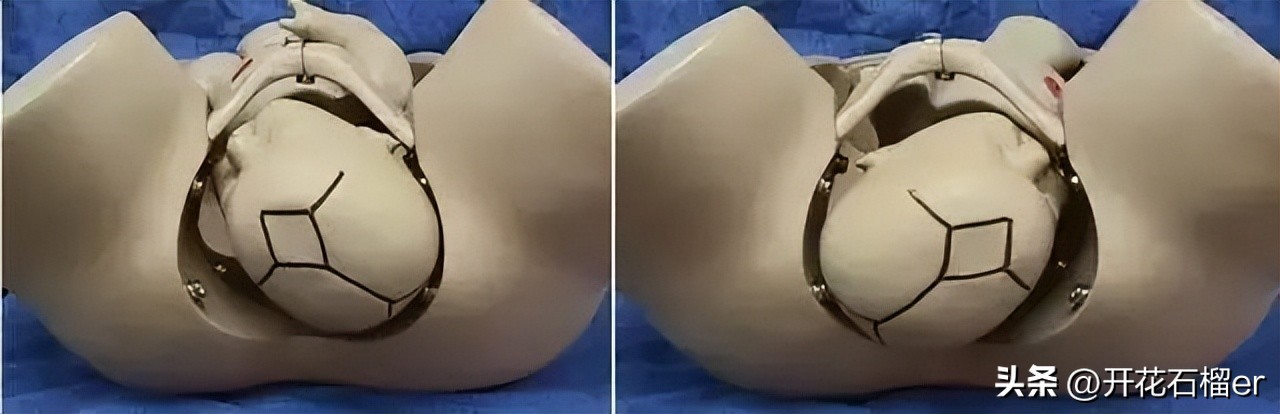 胎儿几个月容易胎停,怀孕胎位不正多少周定胎位好一点