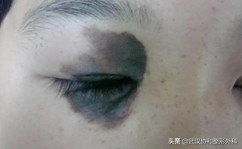 熊猫很漂亮但是很害羞,萌宝大熊猫的痣是天生的吗