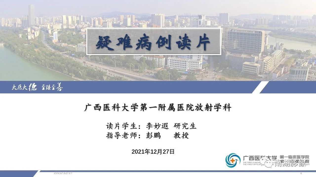 肾上腺海绵状血管瘤,肾上腺血管瘤是良性还是恶性