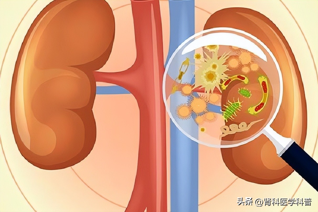 利妥昔单抗能治疗膜性肾病？