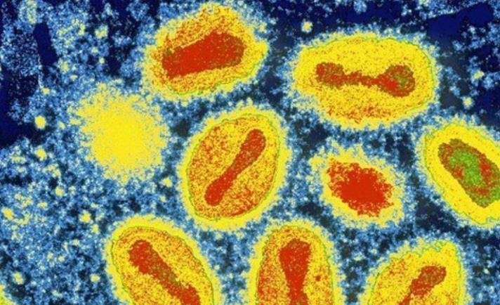 世界上最致命的病毒九种,细菌和病毒哪个更致命