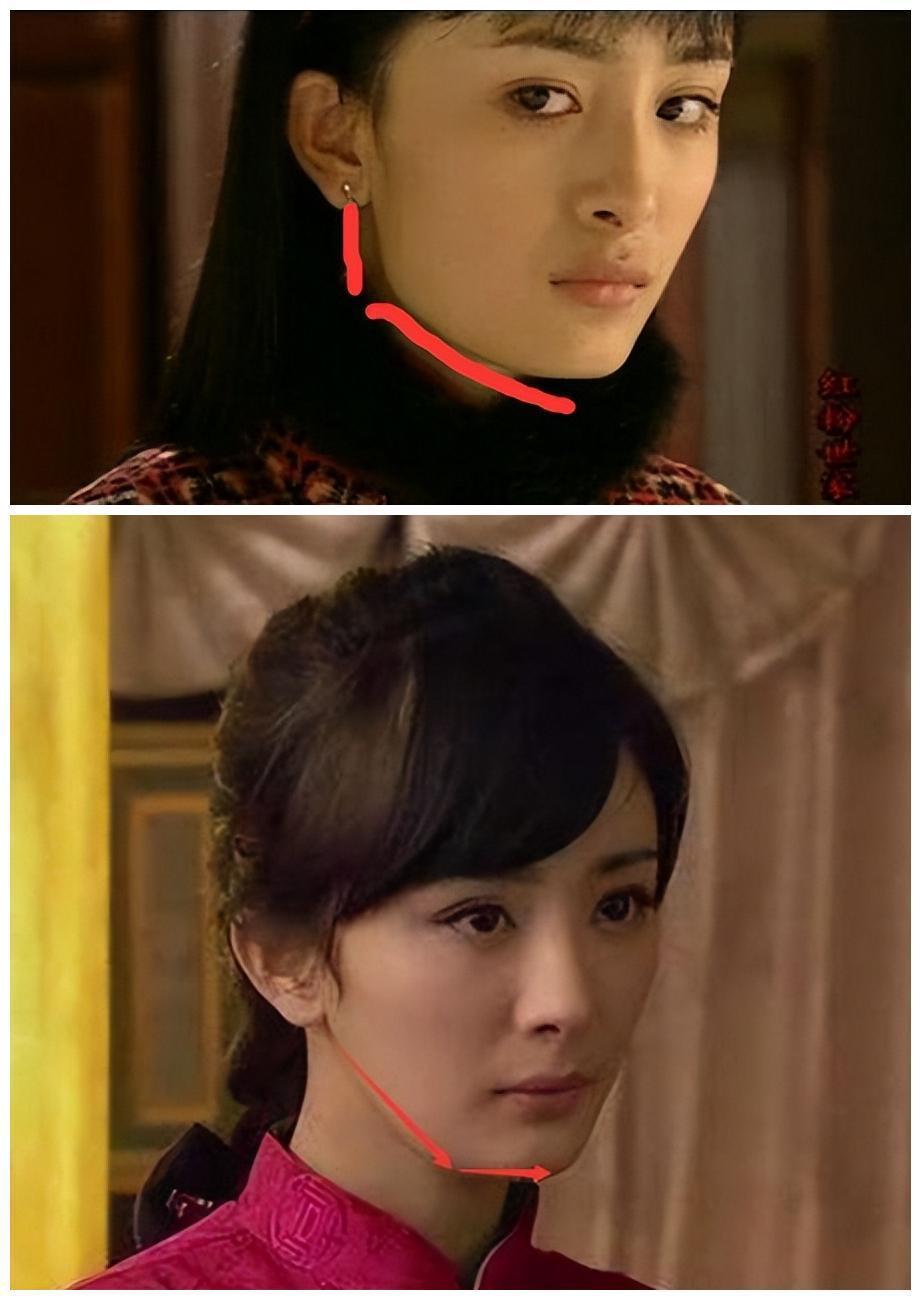 娱乐圈的整容脸,为什么娱乐圈那么多整容脸