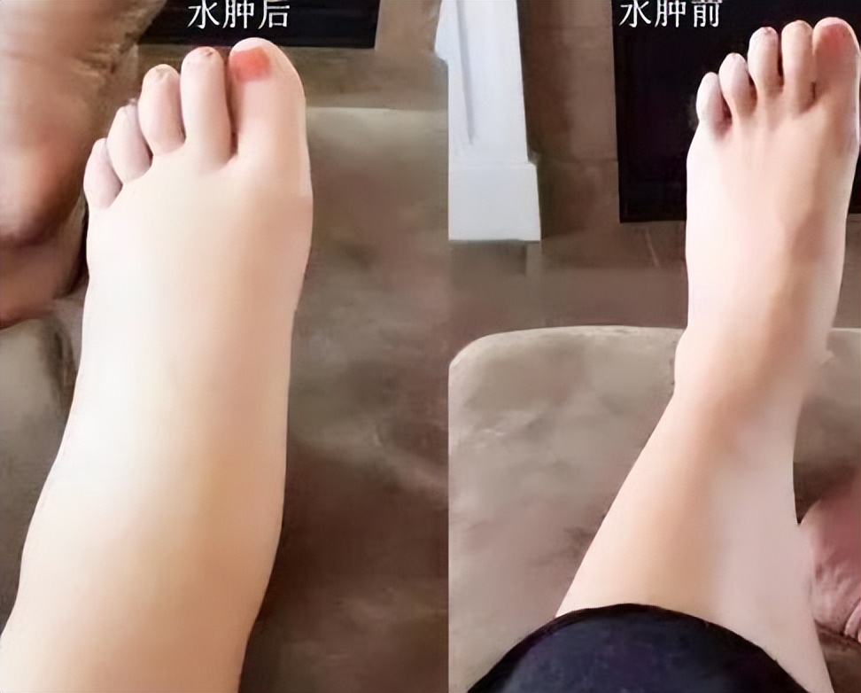 节节草能长期泡水喝吗有什么功效,老人用节节草泡脚的功效