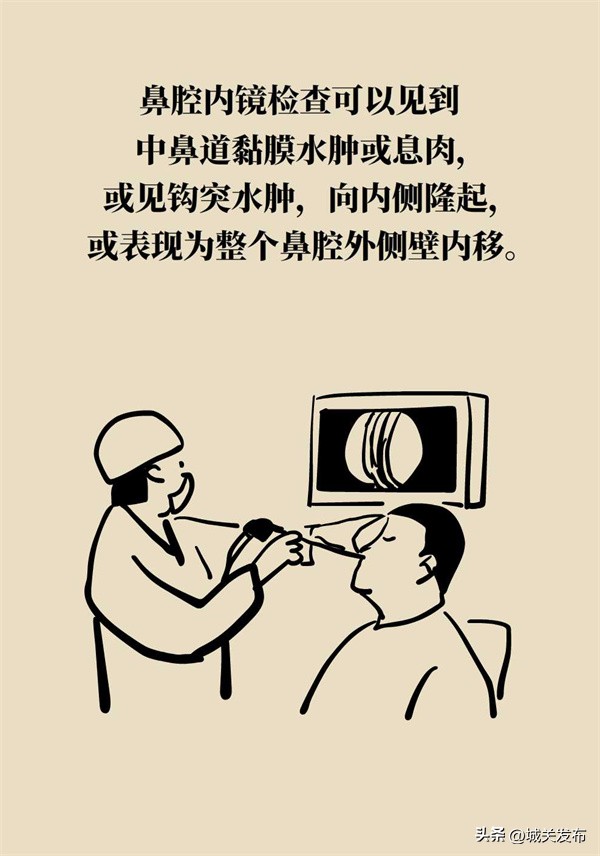 鼻子发霉怎么办,鼻子里因为异物发臭用什么药处理