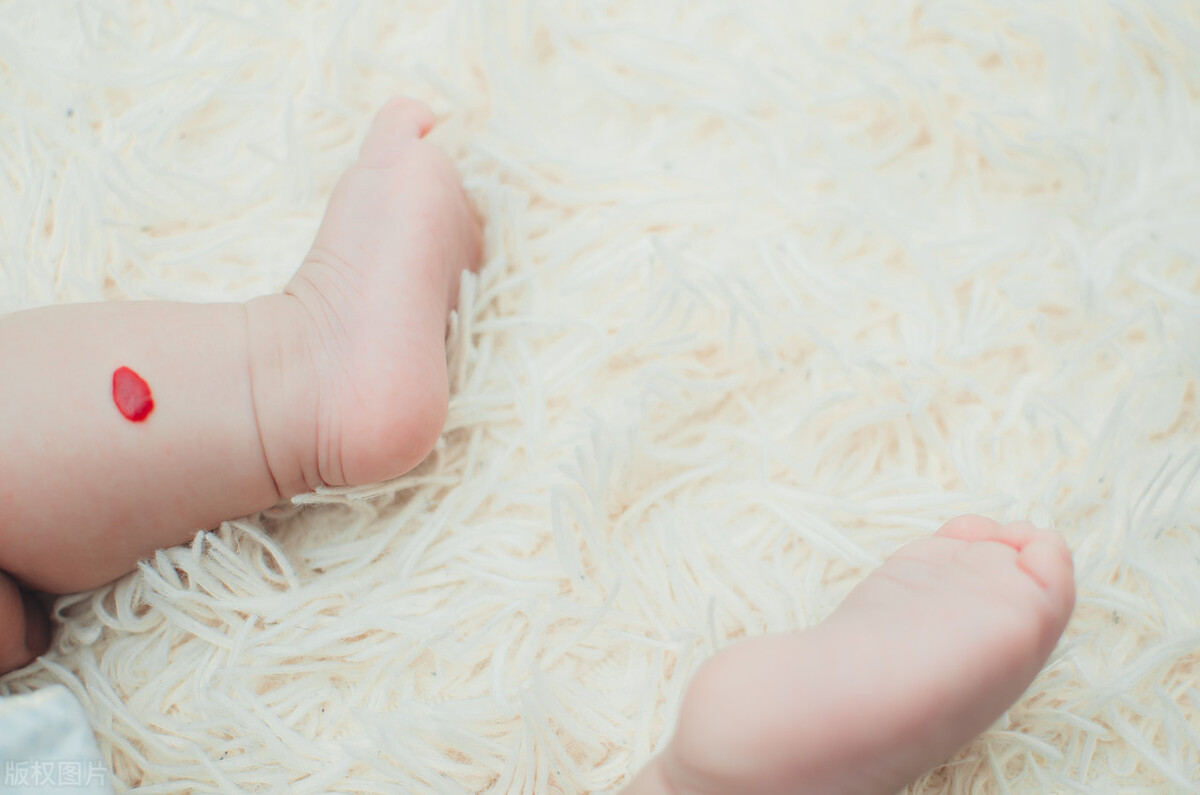 婴儿血管瘤最佳治疗方法外用药,婴儿血管瘤破了有危险吗