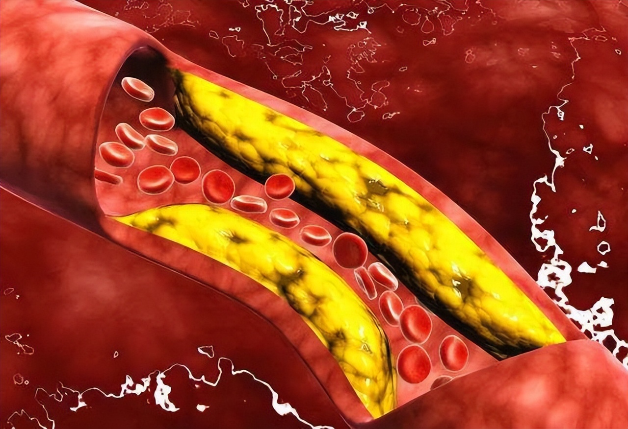 身高170公分男性标准体重是多少,身高170厘米的男性体重应该是多少