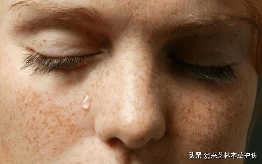 不要再瞎折腾自己的皮肤,别再花冤枉钱了祛斑