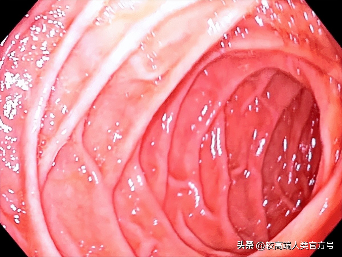 人类最深的洞,人类身上的洞