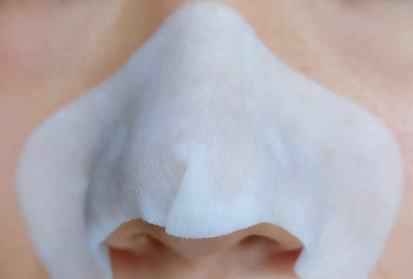 女生有黑头的正确消除方法,生活妙招去黑头3招告别草莓鼻